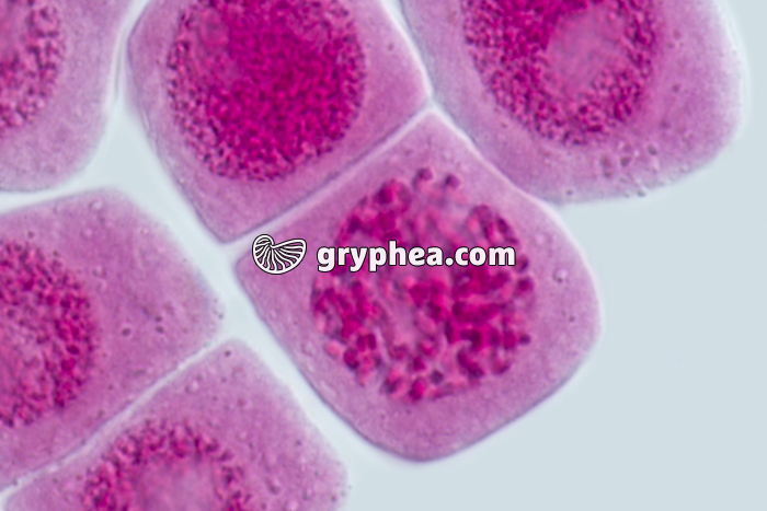 Mitose racine d'Ail DEBUT PROPHASE x640 - gryphea.com